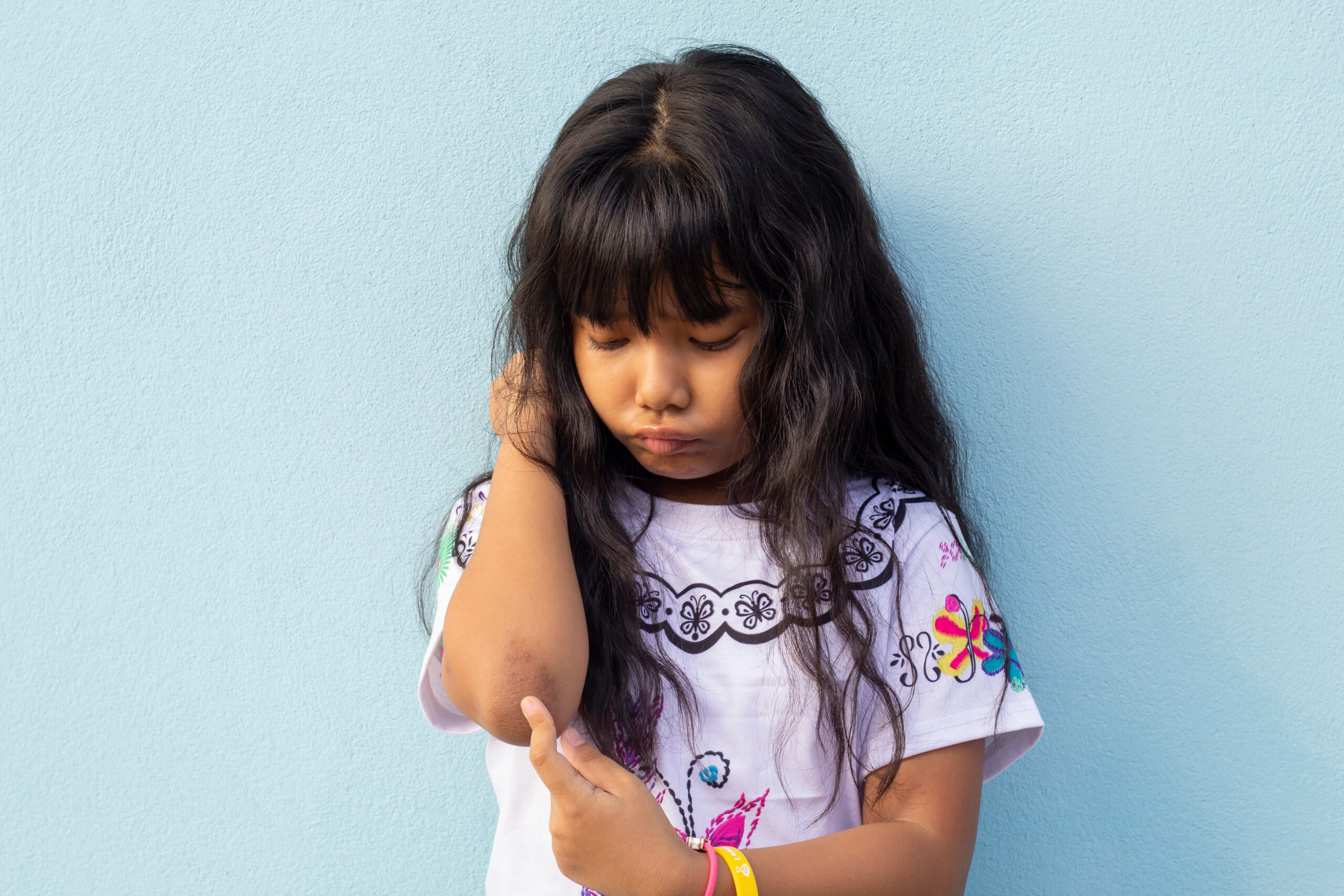 Acanthosis Nigricans can appear in all ages and all race groups