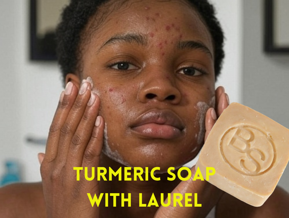 Wash your face with Turmeric soap to control acne